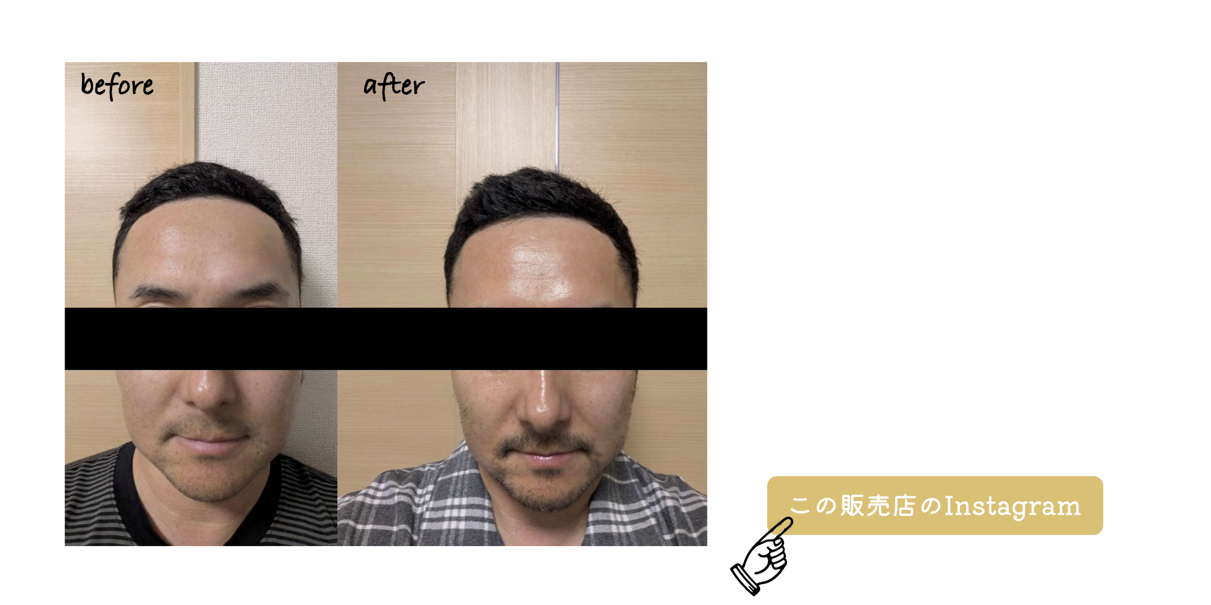 Before After 2