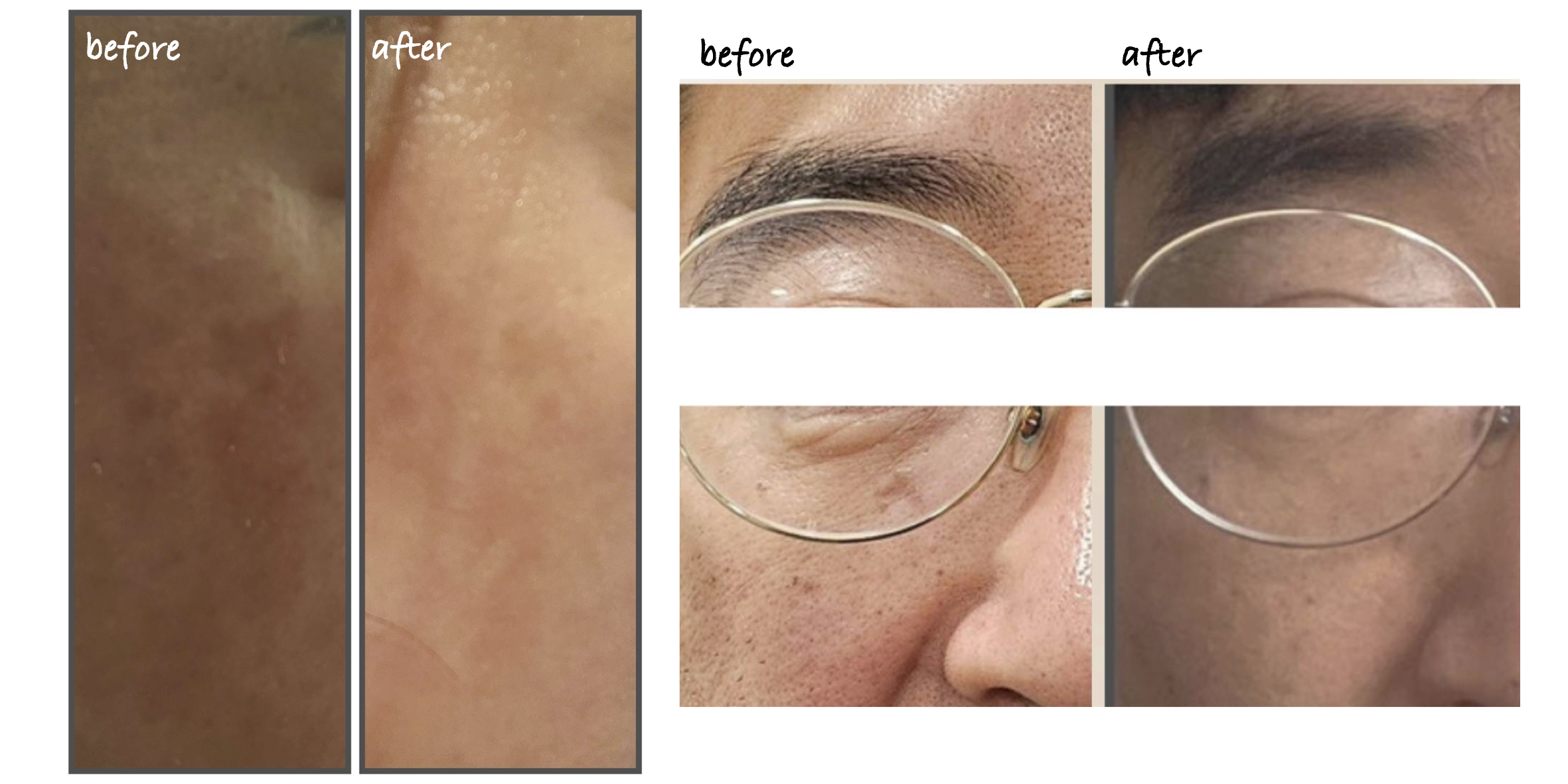 Before After 5
